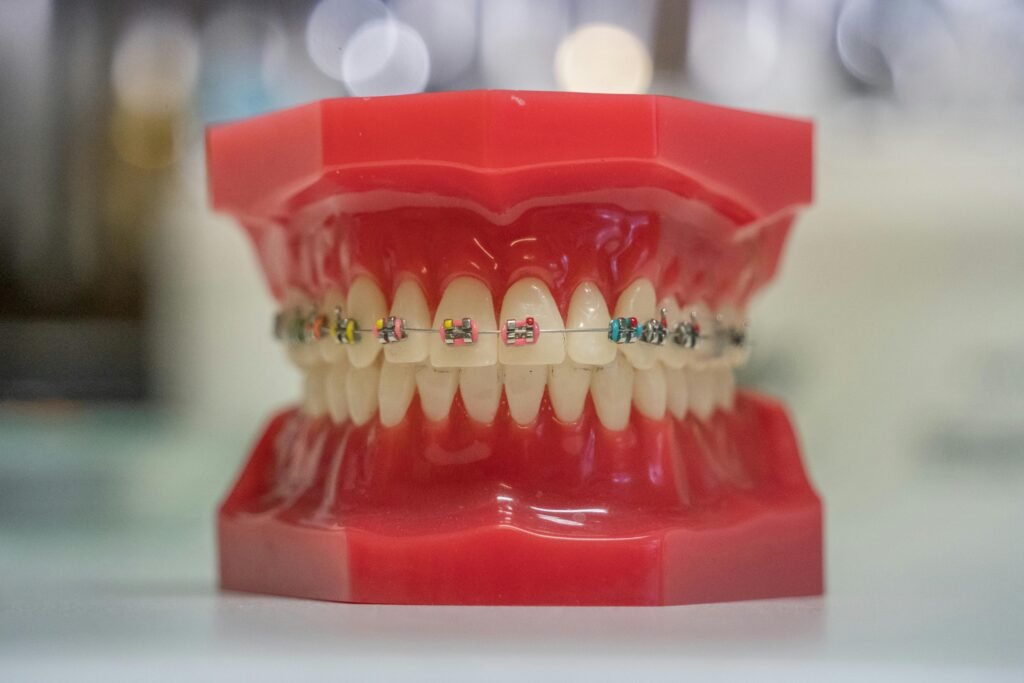 Model of human teeth with colorful braces, showcasing dental care and orthodontics.